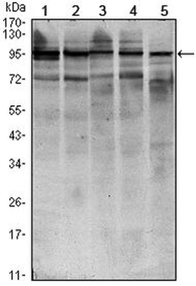 STAT6 Antibody in Western Blot (WB)