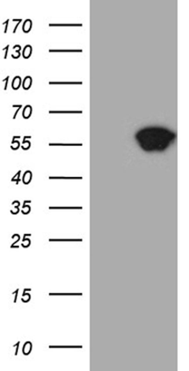 STAU1 Antibody in Western Blot (WB)