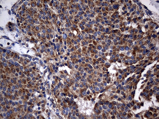 STBD1 Antibody in Immunohistochemistry (Paraffin) (IHC (P))