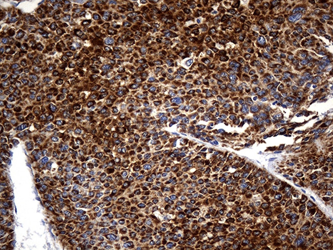 STBD1 Antibody in Immunohistochemistry (Paraffin) (IHC (P))