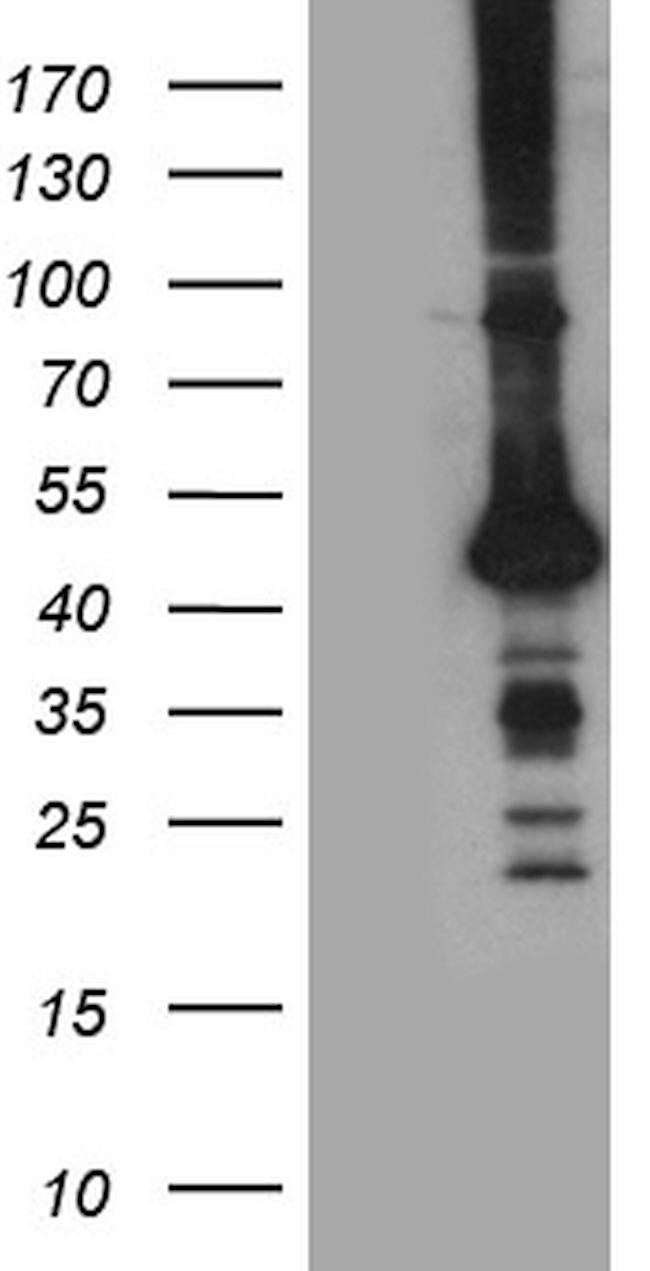 STBD1 Antibody in Western Blot (WB)