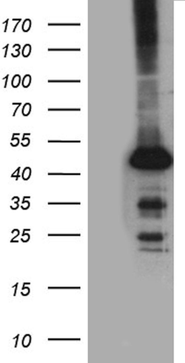 STBD1 Antibody in Western Blot (WB)