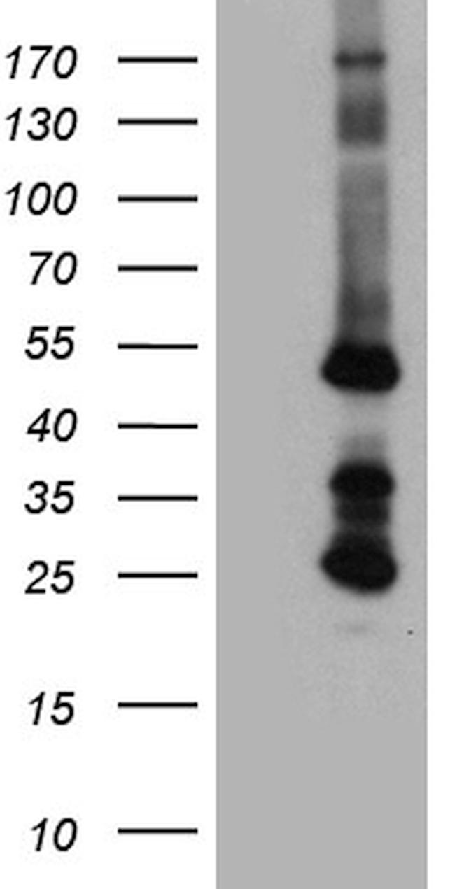 STBD1 Antibody in Western Blot (WB)