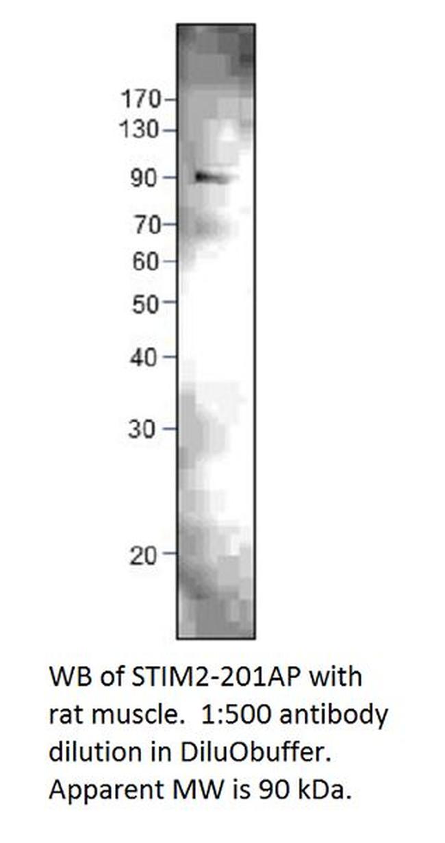 STIM2 Antibody in Western Blot (WB)