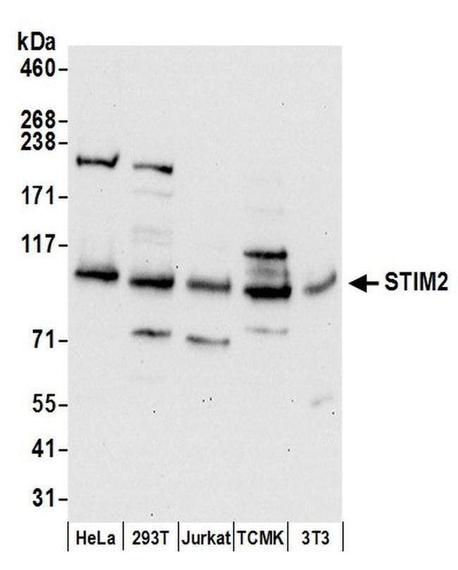 STIM2 Antibody in Western Blot (WB)