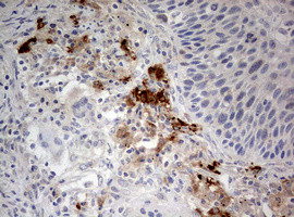 STK11 Antibody in Immunohistochemistry (Paraffin) (IHC (P))