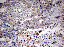 STK11 Antibody in Immunohistochemistry (Paraffin) (IHC (P))