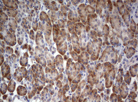 STK11 Antibody in Immunohistochemistry (Paraffin) (IHC (P))