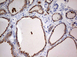 STK11 Antibody in Immunohistochemistry (Paraffin) (IHC (P))