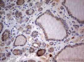 STK11 Antibody in Immunohistochemistry (Paraffin) (IHC (P))