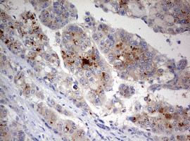 STK11 Antibody in Immunohistochemistry (Paraffin) (IHC (P))