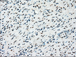 STK3 Antibody in Immunohistochemistry (Paraffin) (IHC (P))