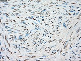 STK3 Antibody in Immunohistochemistry (Paraffin) (IHC (P))