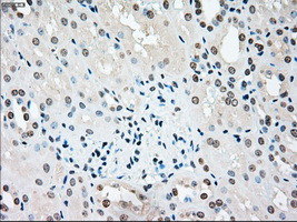 STK3 Antibody in Immunohistochemistry (Paraffin) (IHC (P))