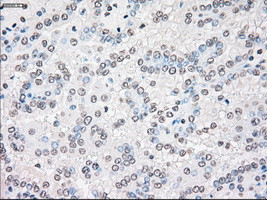 STK3 Antibody in Immunohistochemistry (Paraffin) (IHC (P))