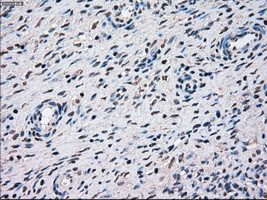 STK3 Antibody in Immunohistochemistry (Paraffin) (IHC (P))