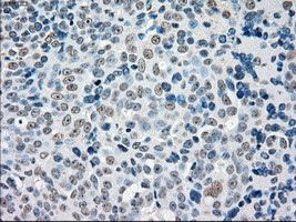 STK3 Antibody in Immunohistochemistry (Paraffin) (IHC (P))