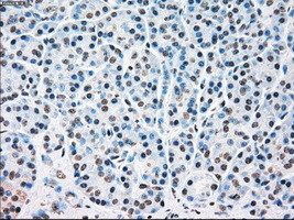 STK3 Antibody in Immunohistochemistry (Paraffin) (IHC (P))