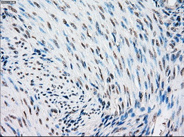 STK3 Antibody in Immunohistochemistry (Paraffin) (IHC (P))