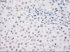 STK3 Antibody in Immunohistochemistry (Paraffin) (IHC (P))