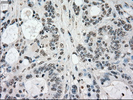 STK3 Antibody in Immunohistochemistry (Paraffin) (IHC (P))