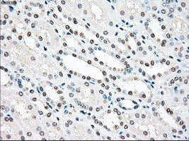 STK3 Antibody in Immunohistochemistry (Paraffin) (IHC (P))