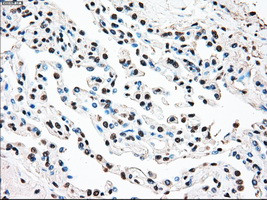 STK3 Antibody in Immunohistochemistry (Paraffin) (IHC (P))