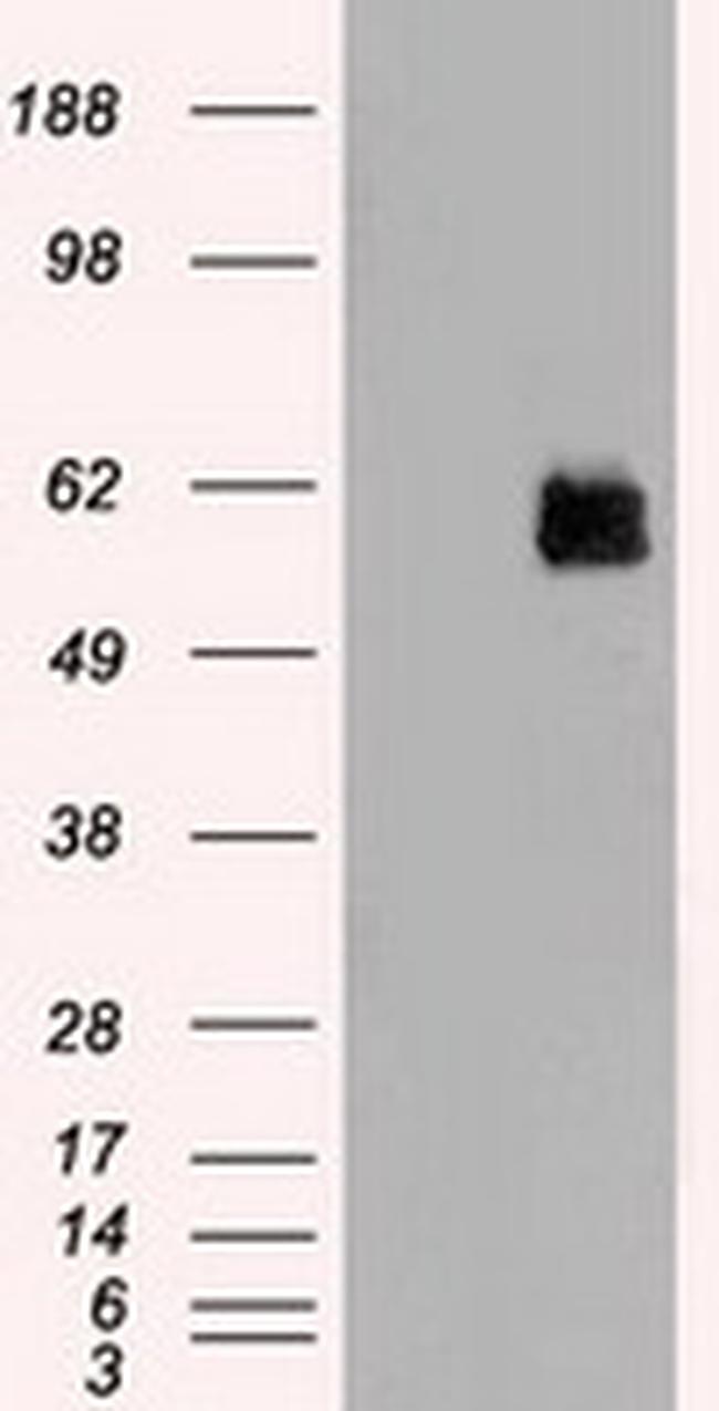 STK3 Antibody in Western Blot (WB)