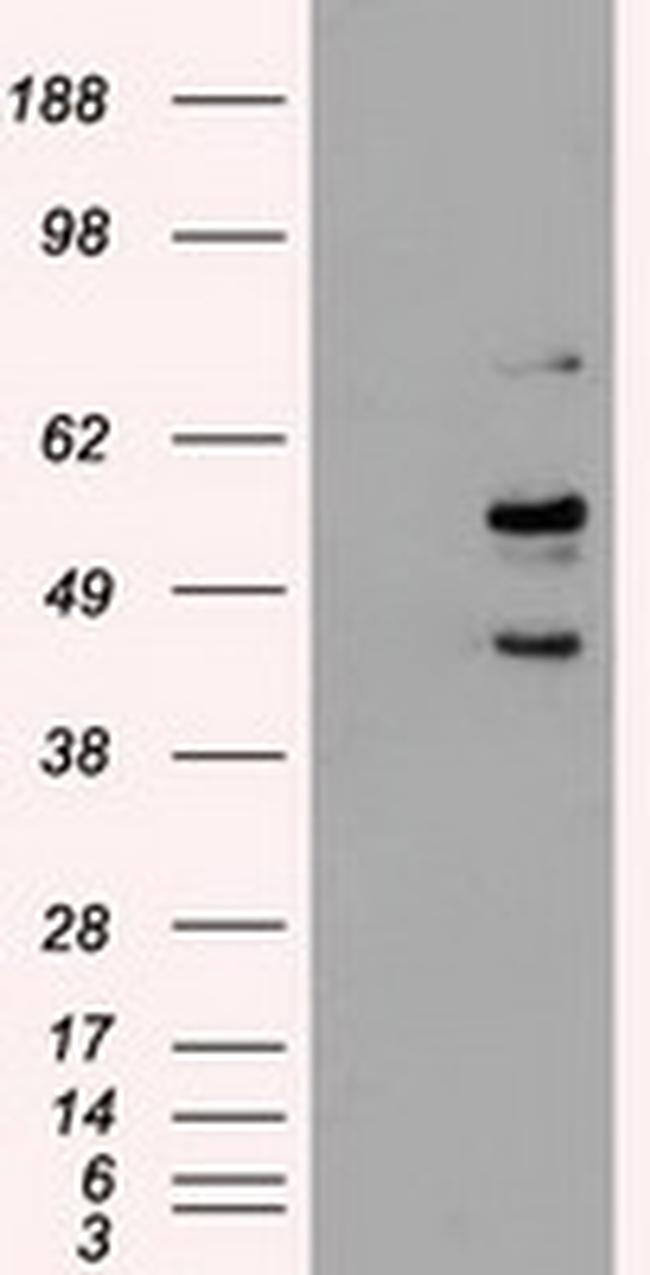 STK3 Antibody in Western Blot (WB)