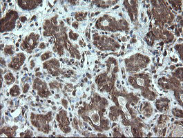 STK38L Antibody in Immunohistochemistry (Paraffin) (IHC (P))