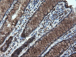 STK38L Antibody in Immunohistochemistry (Paraffin) (IHC (P))