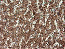 STK38L Antibody in Immunohistochemistry (Paraffin) (IHC (P))