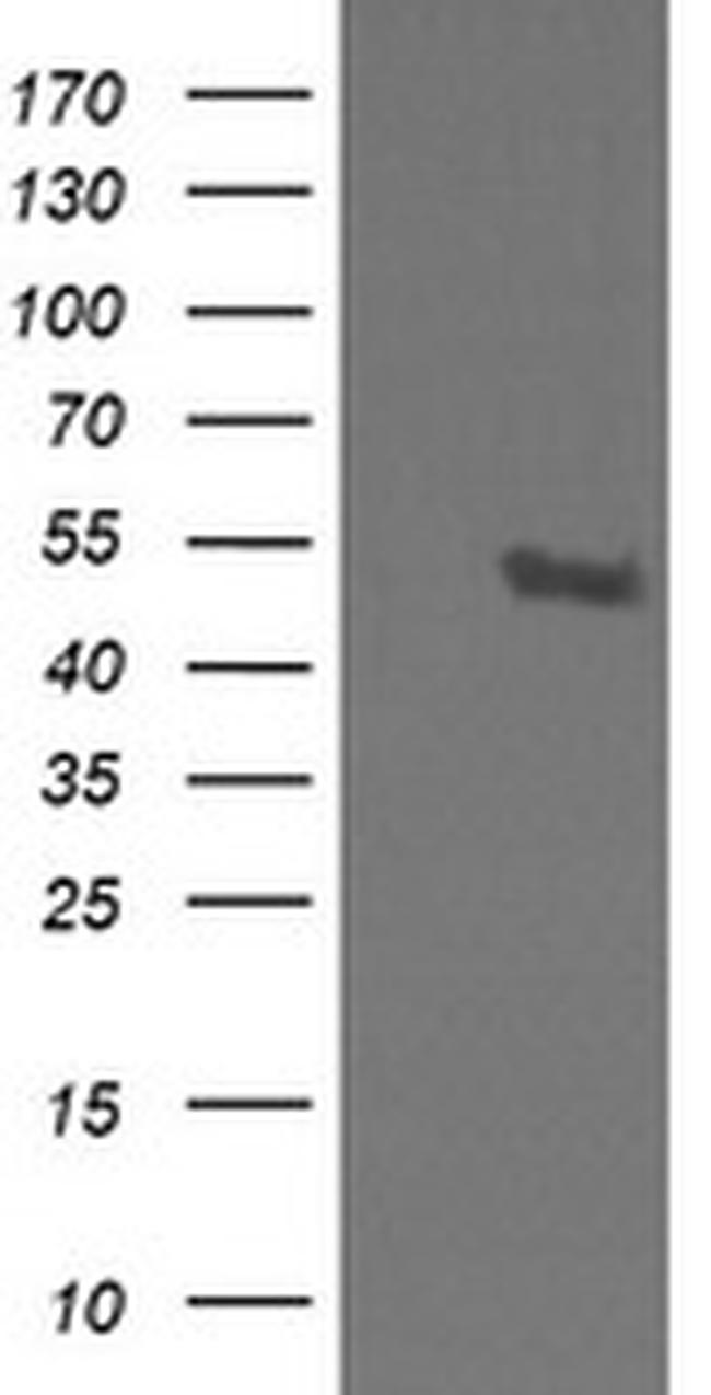 STK38L Antibody in Western Blot (WB)