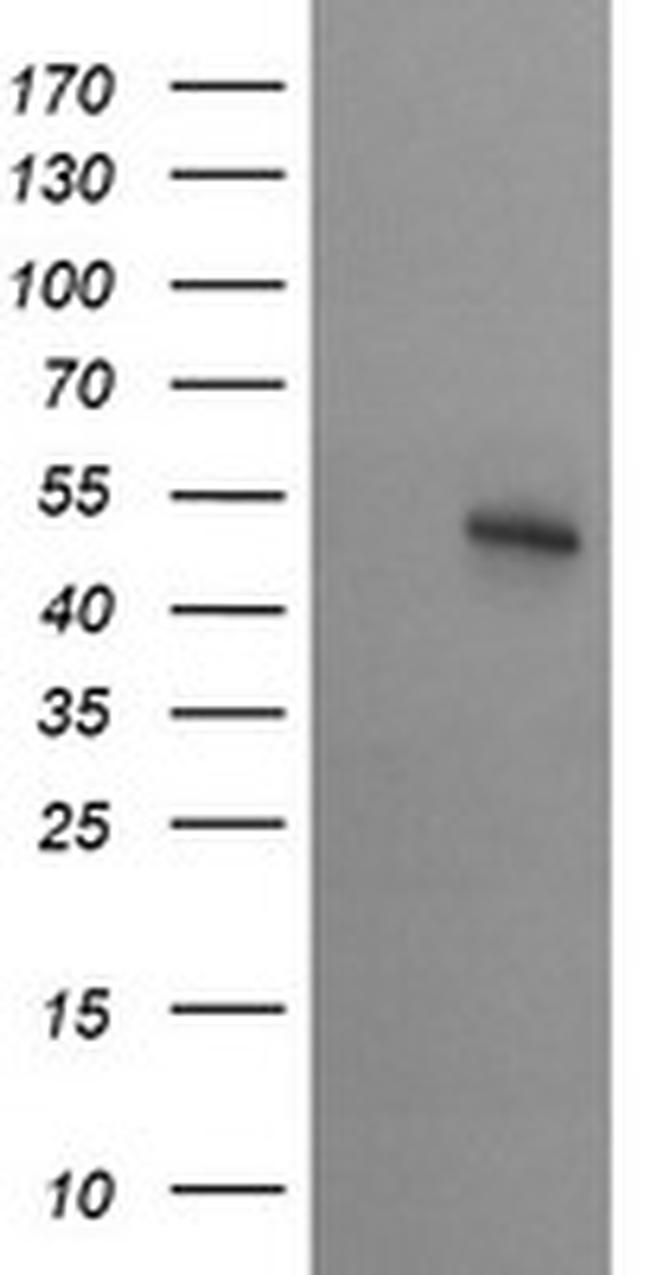 STK38L Antibody in Western Blot (WB)