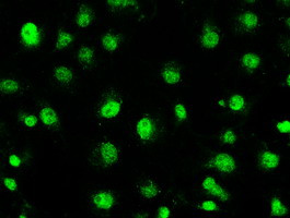 STK39 Antibody in Immunocytochemistry (ICC/IF)