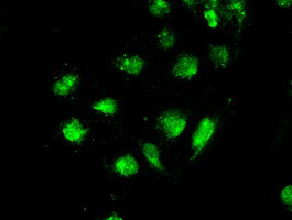 STK39 Antibody in Immunocytochemistry (ICC/IF)