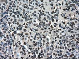 STK39 Antibody in Immunohistochemistry (Paraffin) (IHC (P))