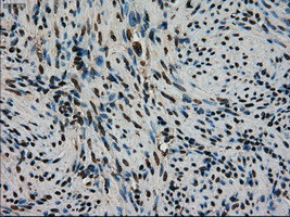 STK39 Antibody in Immunohistochemistry (Paraffin) (IHC (P))