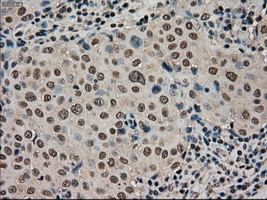 STK39 Antibody in Immunohistochemistry (Paraffin) (IHC (P))