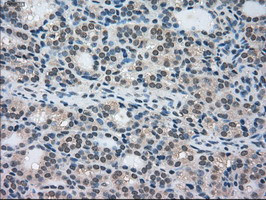 STK39 Antibody in Immunohistochemistry (Paraffin) (IHC (P))