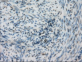 STK39 Antibody in Immunohistochemistry (Paraffin) (IHC (P))