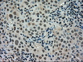 STK39 Antibody in Immunohistochemistry (Paraffin) (IHC (P))