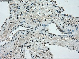 STK39 Antibody in Immunohistochemistry (Paraffin) (IHC (P))