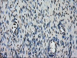 STK39 Antibody in Immunohistochemistry (Paraffin) (IHC (P))