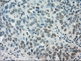 STK39 Antibody in Immunohistochemistry (Paraffin) (IHC (P))