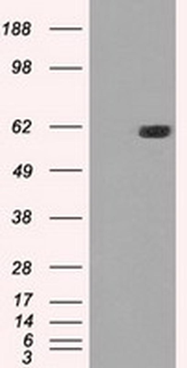 STK39 Antibody in Western Blot (WB)