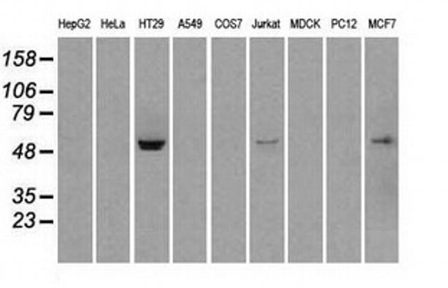 STK39 Antibody in Western Blot (WB)