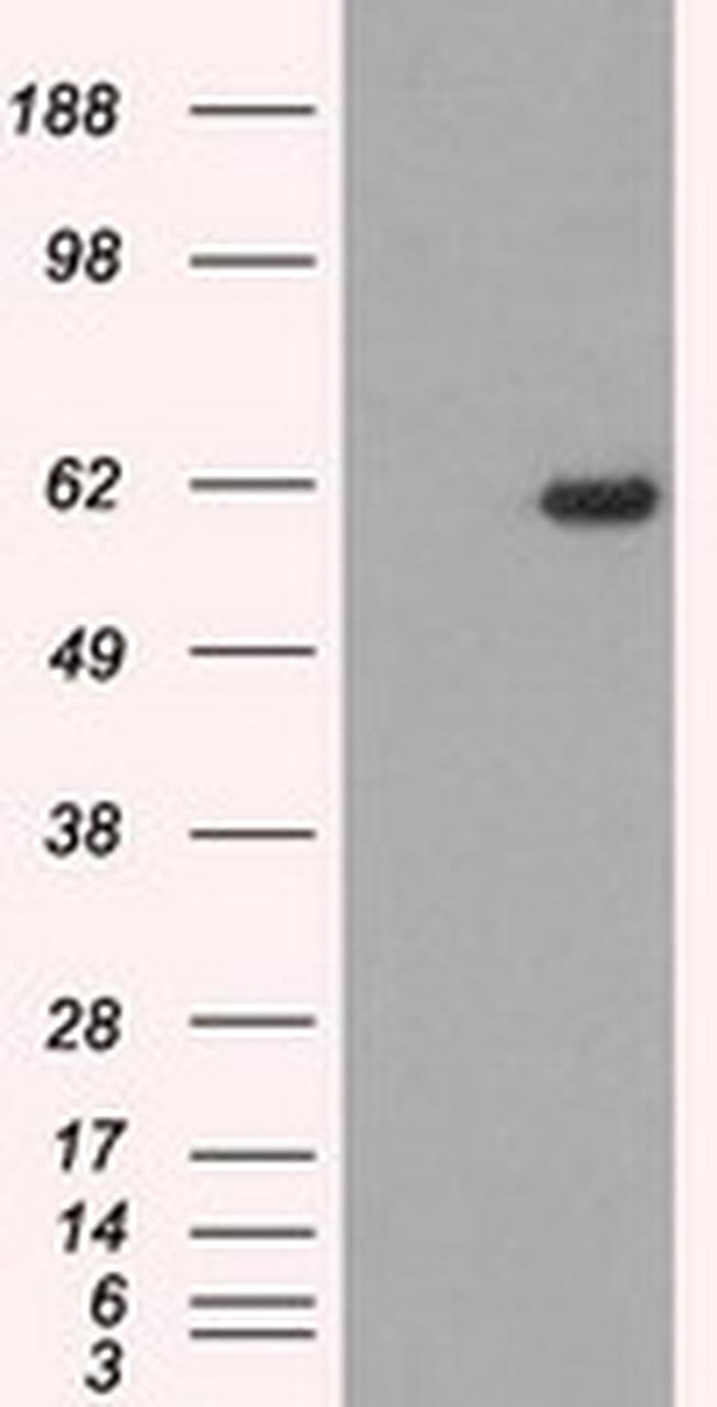 STK39 Antibody in Western Blot (WB)