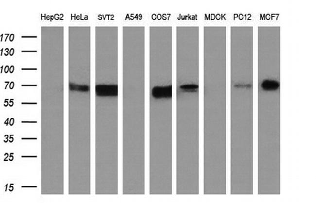 STK39 Antibody in Western Blot (WB)