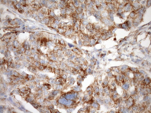 STOML2 Antibody in Immunohistochemistry (Paraffin) (IHC (P))